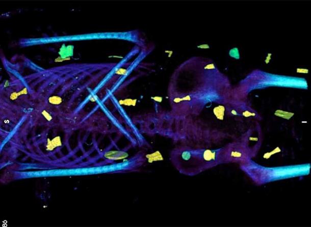 CT scans revealed a number of amulets, many of them made of gold, within the mummified remains known as the Golden Boy mummy. (Saleem, Seddik and el-Halwagy / CC BY 4.0)