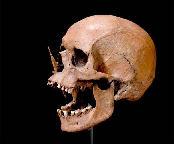 The scientists conducted DNA sequencing on human remains preserved in museums across Europe to understand the evolution of Multiple Sclerosis. (The Danish National Museum)