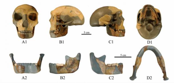 The shape of the mandible indicates that this archaic human did not have a chin.  (Wu et al., Journal of Human Evolution, 2023)