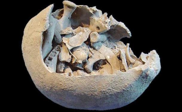 A skull cap used as a funerary receptacle in which the mutilated and burnt bones of the same individual were deposited.