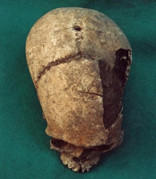 A skull with a hole drilled in the center, which is believed to have been hung from the front wall of the Temple