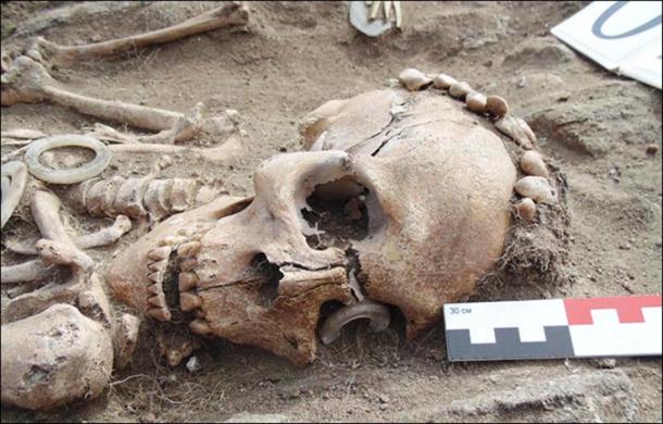 man's skeleton had a ring made of rare white jade over one eye socket. 