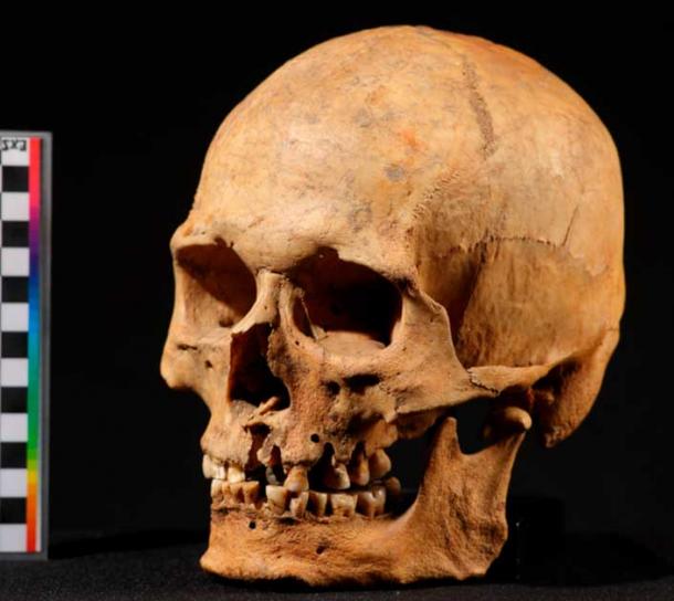 The skull of the Nizhnetytkesken individual which has provided genetic evidence used in the study. (Sergey V. Semenov)