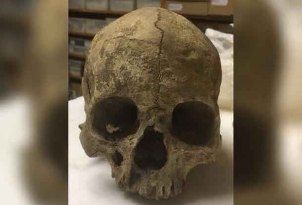 Las inquietantes cuencas vacías del cráneo de Greta están en silencio, pero la datación por carbono ha demostrado que era una mujer medieval que probablemente fue decapitada. (David Adkins / StaffordshireLive)