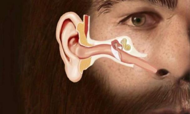 The structure of the Eustachian Tube in a Neanderthal male and it's similarity to the human infant. (SUNY Downstate Health Sciences University)