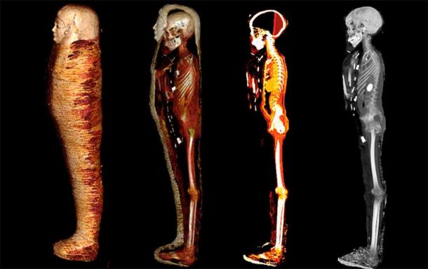 Una serie de imágenes del estudio, incluidas tomografías computarizadas que "desempaquetado digitalmente" la momia del niño dorado. Fuente: Saleem, Seddik y el-Halwagy / CC BY 4.0
