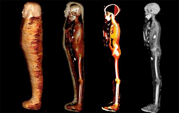 A series of images from the study, including CT scans that 