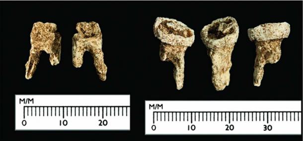 The Viking’s teeth