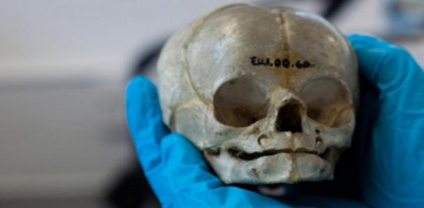 Scientist holding the tiny skull of an infant.