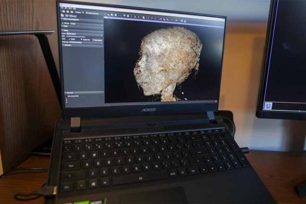 High-tech medical tools were used to hunt for cancer origins in the 2,000-year-old female Egyptian mummy’s head shown here. (Albert Zawada / Science in Poland)