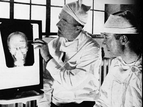 Walter Freeman (left) and James Watts study an x-ray prior to conducting ‘psychosurgery’.