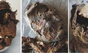 High-impact shocks to the face and skull. Source: Standen et al. / Journal of Anthropological Archaeology