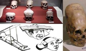 Skulls from the Andean Paracas (top left). (CC BY-SA 3.0); Paracas skull at Ica Museum(right). (CC BY 2.0); Child head shaping methods (bottom left).