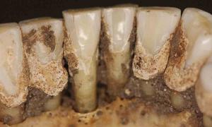 New study will help us understand more about ancient trippers by testing ancient teeth. Source: Line S. Larsen / Science