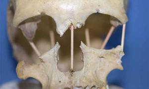 Genetic Study of Romanian Skull Upends Previous Theories of Evolution