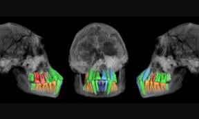 Skull and dentition of a young individual of early Homo from Dmanisi
