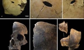 Examples of skulls from the assemblage, with evidence for blunt force trauma and cut marks.	