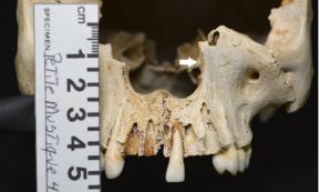 It was this skull, found on the uninhabited island of Petite Mustique in the Caribbean, that was used in the recent leprosy research study.					Source: International Journal of Paleopathology