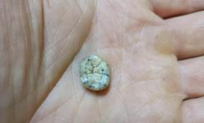 Evidence of Denisovans in Southeast Asia is growing one tooth at a time based on the recent find in Laos. The molar attributed to a young female individual of the extinct human species called the Denisovans was found in cave Tam Ngu Hao 2 in northeastern Laos.	Source: Fabrice Demeter / Handout via Reuters
