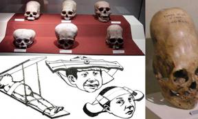 Skulls from the Andean Paracas (top left). (CC BY-SA 3.0); Paracas skull at Ica Museum(right). (CC BY 2.0); Child head shaping methods (bottom left).