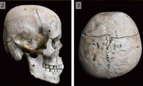 Modified Hirota skull, Japan. Source: Noriko Seguchi/The Kyushu University Museum/PLOS ONE