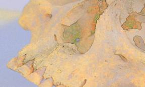 Special imaging of 4,000-year-old skull from which two genomes of Mycobacterium lepromatosis  were sourced.