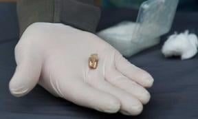 This lower jaw tooth of an early human species, from roughly 1.8 million years ago, discovered at the Orozmani site in southern Georgia, provides more evidence that the first humans left Africa and wandered northeast. Source: Municipality Of Dmanisi