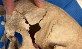 Damaged cranium of one of the warrior monks
