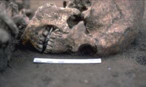 Why Did a Roman Era Corpse Have His Tongue Cut Out and a Stone Placed in His Mouth?