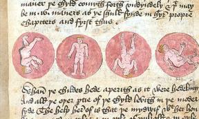 Medieval medical text 