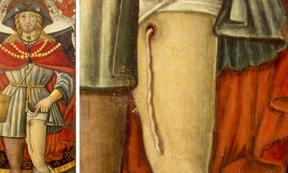 A painting of 14th century St. Roch shows the dracunculiasis worm exiting the upper part of his leg.