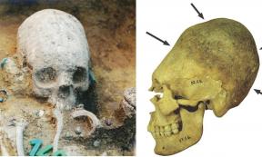 Left: Upper part of the body of grave 43 during excavation. The girl had an artificially deformed skull, was place in a grave with a side niche and richly equipped with a necklace, earrings, a comb and glass beads. The girl belonged to a group of people with a non-local origin and similar dietary habits, which appeared to have arrived at the site about 10 years after its establishment. (Wosinsky Mór Museum)         Right: Artificially deformed skull of an adult woman. Permanent binding during childhood caus