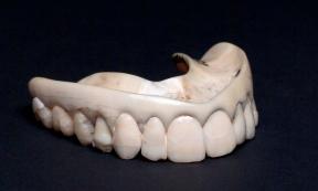 Upper ivory denture with human teeth. Source: Science Museum, London / CC BY 4.0