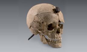 Iron Age Iberian skull with nail driven through its head, recovered by archaeologists at site in Ullastret, Spain.