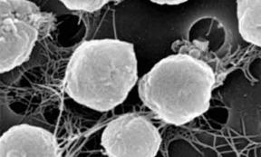 Life Origins - Organisms like Archaea