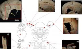 Distribution and examples of perimortem skeletal lesions at Cornaux
