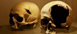 Skulls showing battle injuries. Source: Jan / Adobe Stock.