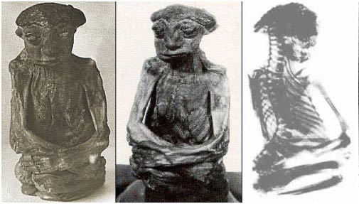 Fotos y radiografía de la Momia de San Pedro