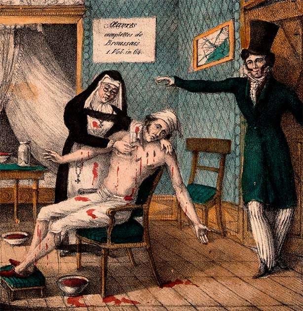 An undated French satirical cartoon—one of many of its kind—depicts a man urging a nurse to bleed a weary patient with leeches. Source: Wellcome Collection / Public Domain.